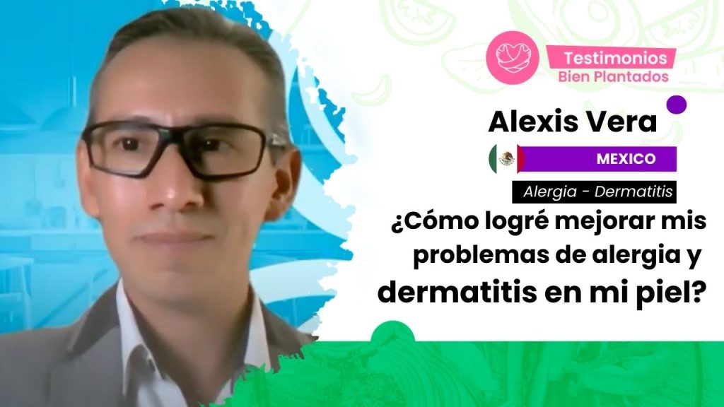 bien plantado dra adriana cortes alexis vera alergia dermatitis